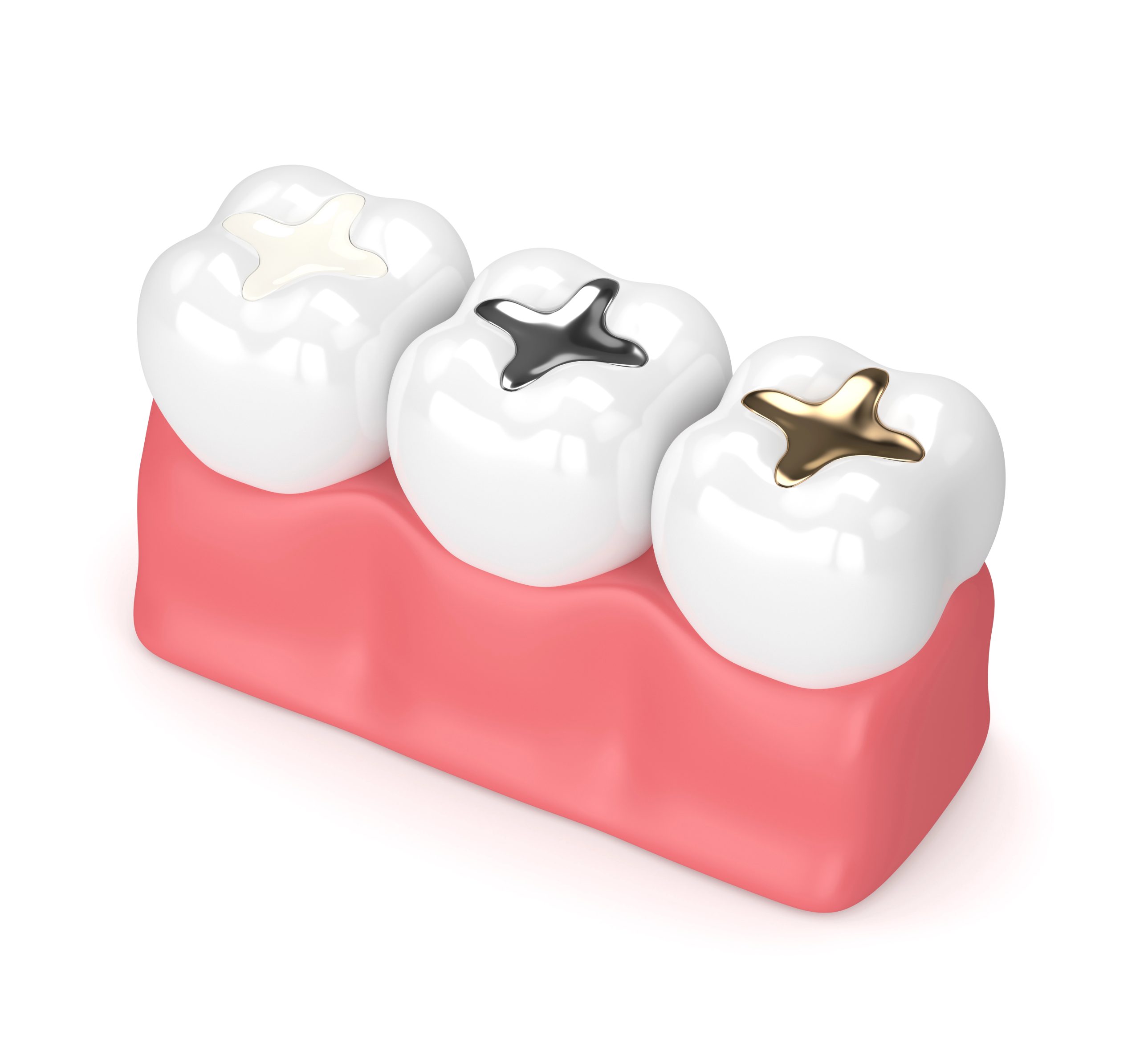 Dental Sealants for Adults: Cavity Protection at Any Age